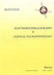 Go to journal home page - Electroencephalography and Clinical Neurophysiology